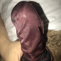 锦纶套丝成瘾患者